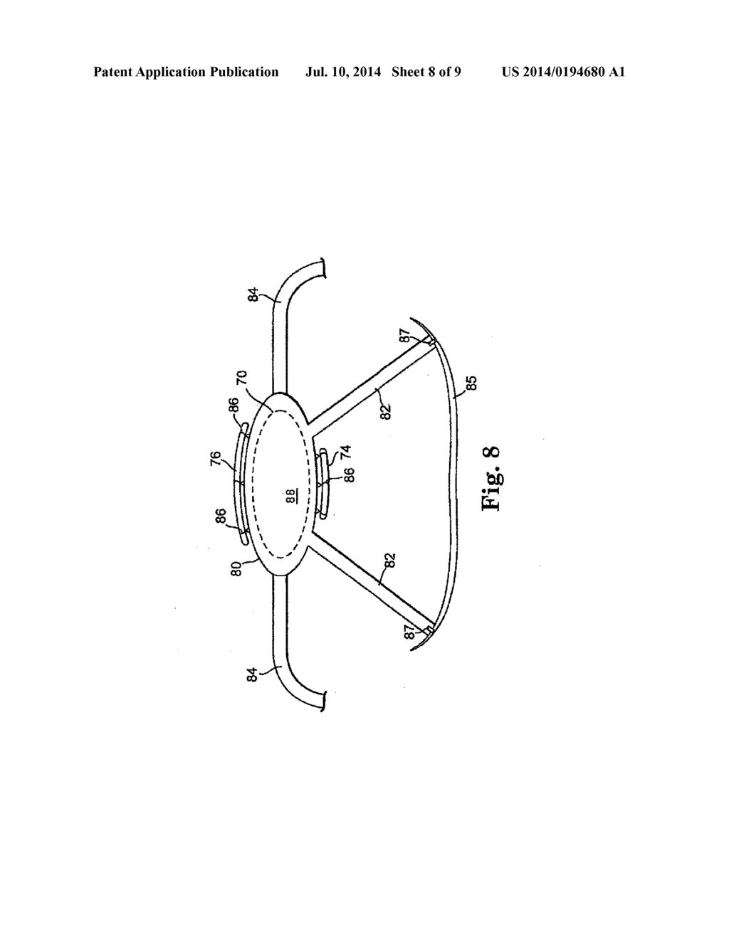 METHOD FOR SUPPORTING VAGINAL CUFF - diagram, schematic, and image 09