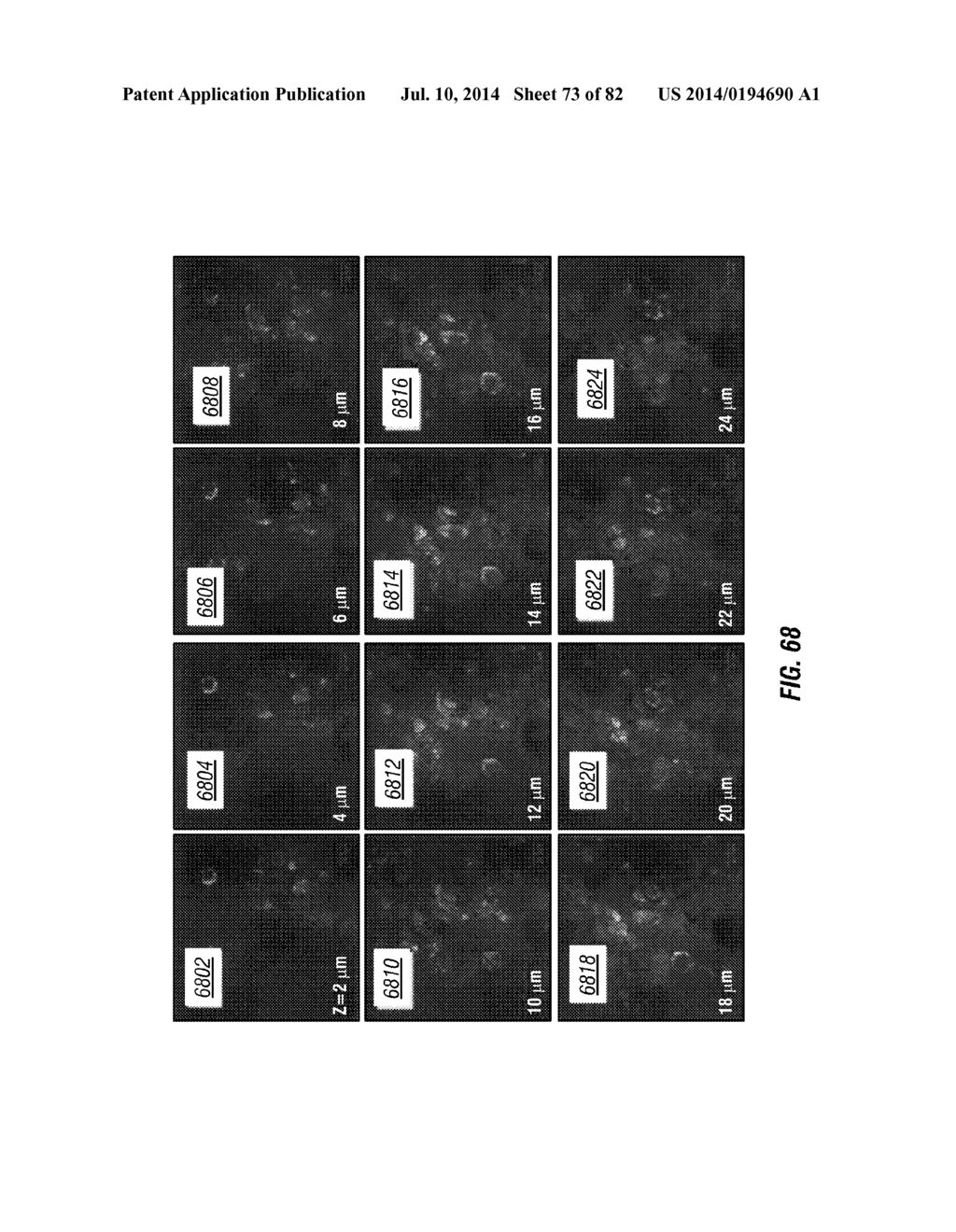 CHEMICALLY-SELECTIVE, LABEL FREE, MICROENDOSCOPIC SYSTEM BASED ON COHERENT     ANTI-STOKES RAMAN SCATTERING - diagram, schematic, and image 74