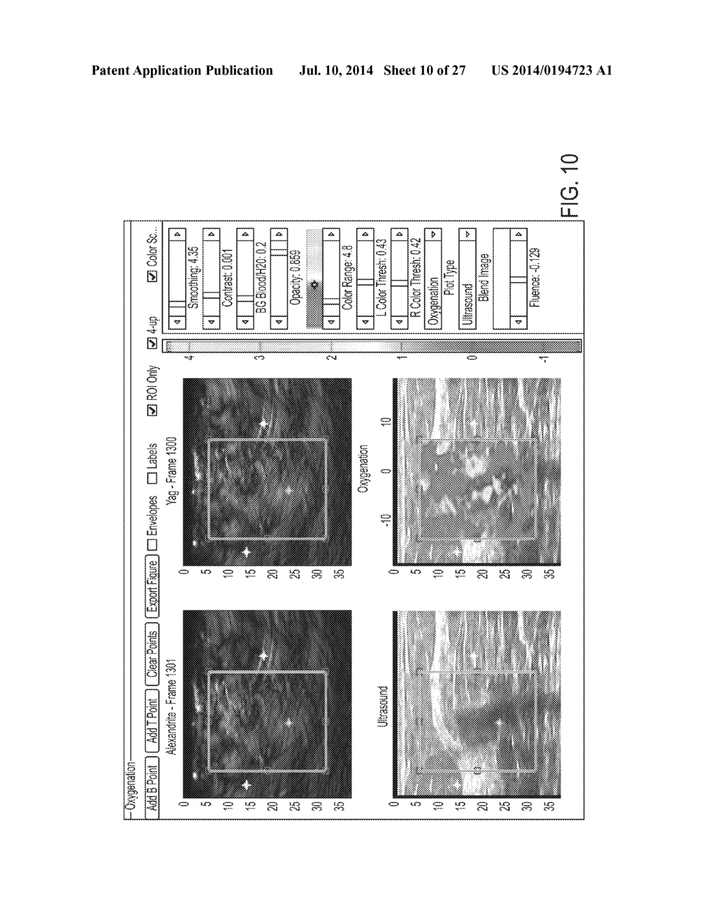 MULTI-LAYER COATING FOR OPTOACOUSTIC PROBE - diagram, schematic, and image 11