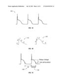 METHODS AND SYSTEMS FOR TREATING HEART INSTABILITY diagram and image