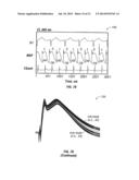 METHODS AND SYSTEMS FOR TREATING HEART INSTABILITY diagram and image