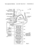 METHODS AND SYSTEMS FOR TREATING HEART INSTABILITY diagram and image