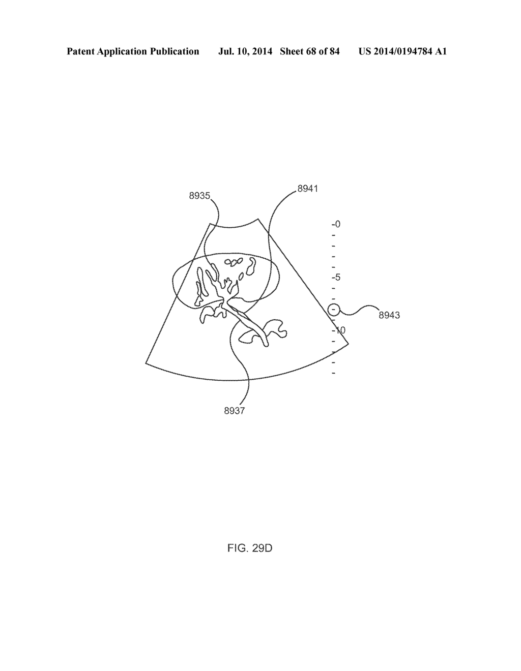 METHODS AND DEVICES FOR THERMALLY INDUCED HEPATIC NEUROMODULATION - diagram, schematic, and image 69