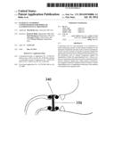 EXTERNAL ANCHORING CONFIGURATIONS FOR MODULAR GASTROINTESTINAL PROSTHESES diagram and image