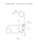 EXTERNAL ANCHORING CONFIGURATIONS FOR MODULAR GASTROINTESTINAL PROSTHESES diagram and image