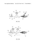 EXTERNAL ANCHORING CONFIGURATIONS FOR MODULAR GASTROINTESTINAL PROSTHESES diagram and image