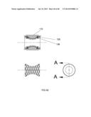 EXTERNAL ANCHORING CONFIGURATIONS FOR MODULAR GASTROINTESTINAL PROSTHESES diagram and image