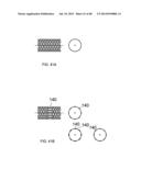 EXTERNAL ANCHORING CONFIGURATIONS FOR MODULAR GASTROINTESTINAL PROSTHESES diagram and image