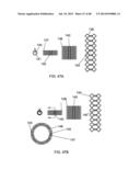 EXTERNAL ANCHORING CONFIGURATIONS FOR MODULAR GASTROINTESTINAL PROSTHESES diagram and image