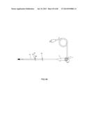 EXTERNAL ANCHORING CONFIGURATIONS FOR MODULAR GASTROINTESTINAL PROSTHESES diagram and image