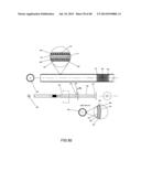 EXTERNAL ANCHORING CONFIGURATIONS FOR MODULAR GASTROINTESTINAL PROSTHESES diagram and image