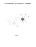 EXTERNAL ANCHORING CONFIGURATIONS FOR MODULAR GASTROINTESTINAL PROSTHESES diagram and image