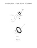 EXTERNAL ANCHORING CONFIGURATIONS FOR MODULAR GASTROINTESTINAL PROSTHESES diagram and image