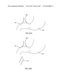 EXTERNAL ANCHORING CONFIGURATIONS FOR MODULAR GASTROINTESTINAL PROSTHESES diagram and image