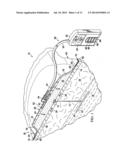 DRESSING ASSEMBLIES FOR WOUND TREATMENT USING REDUCED PRESSURE diagram and image