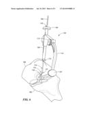 SURGICAL AIMING DEVICE diagram and image