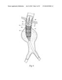 SYSTEMS AND METHODS FOR ATTACHING A PROSTHESIS WITHIN A BODY LUMEN OR     HOLLOW ORGAN diagram and image