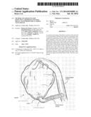 METHOD AND APPARATUS FOR EFFECTING A MINIMALLY INVASIVE DISTAL ANASTOMOSIS     FOR AN AORTIC VALVE BYPASS diagram and image