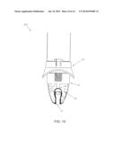 METHOD AND APPARATUS FOR EFFECTING A MINIMALLY INVASIVE DISTAL ANASTOMOSIS     FOR AN AORTIC VALVE BYPASS diagram and image