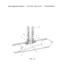 METHOD AND APPARATUS FOR EFFECTING A MINIMALLY INVASIVE DISTAL ANASTOMOSIS     FOR AN AORTIC VALVE BYPASS diagram and image