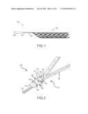 CONNECTION OF AN ENDOVASCULAR INTERVENTION DEVICE TO A MANIPULATION MEMBER diagram and image