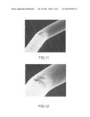 CONNECTION OF AN ENDOVASCULAR INTERVENTION DEVICE TO A MANIPULATION MEMBER diagram and image