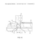 CONNECTION OF AN ENDOVASCULAR INTERVENTION DEVICE TO A MANIPULATION MEMBER diagram and image