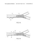 CONNECTION OF AN ENDOVASCULAR INTERVENTION DEVICE TO A MANIPULATION MEMBER diagram and image