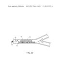 CONNECTION OF AN ENDOVASCULAR INTERVENTION DEVICE TO A MANIPULATION MEMBER diagram and image