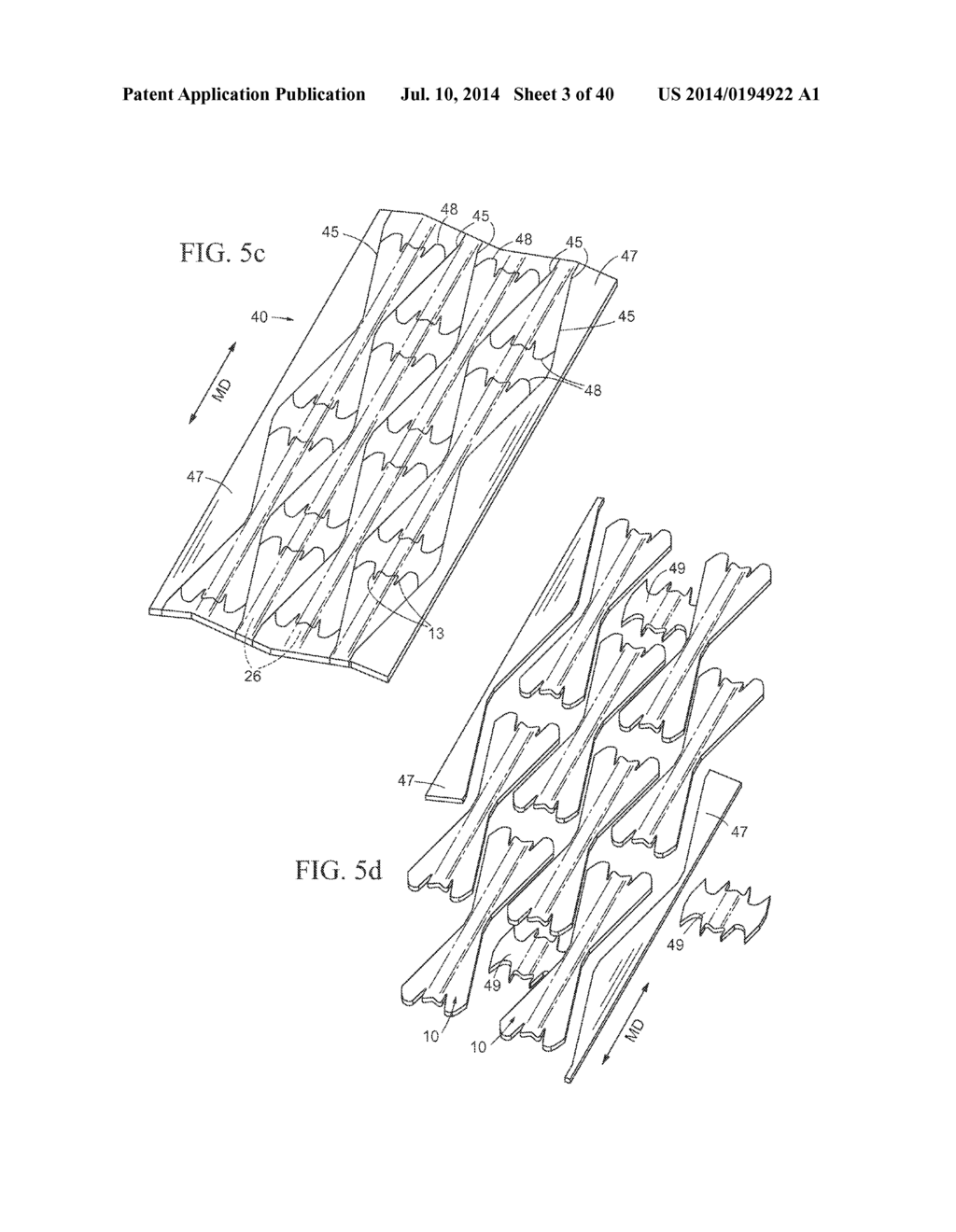 Nasal Dilator and Methods of Fabricating Medical Devices - diagram, schematic, and image 04