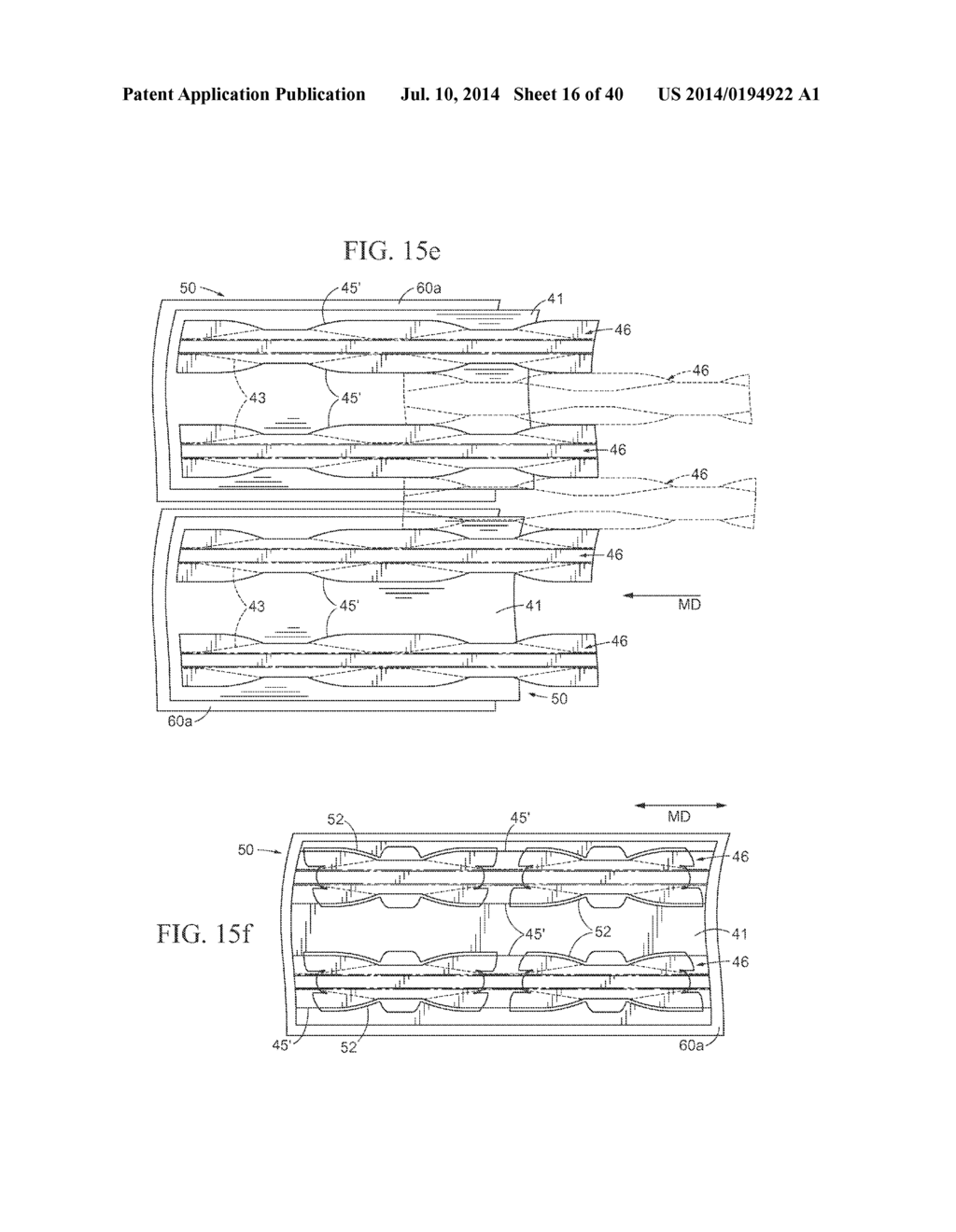 Nasal Dilator and Methods of Fabricating Medical Devices - diagram, schematic, and image 17