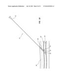 VASCULAR CLOSURE DEVICE WITH IMPROVED SIDE LOADING diagram and image