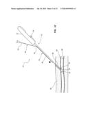 VASCULAR CLOSURE DEVICE WITH IMPROVED SIDE LOADING diagram and image