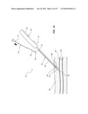 VASCULAR CLOSURE DEVICE WITH IMPROVED SIDE LOADING diagram and image