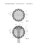 UMBILICAL HERNIA PROSTHESIS diagram and image