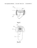 Device and Method of Treating Fungal Nail Infections diagram and image