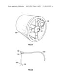 OPHTHALMIC TREATMENT DEVICE, SYSTEM, AND METHOD OF USE diagram and image