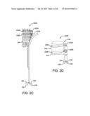 CONTROLLED DEPLOYABLE MEDICAL DEVICE AND METHOD OF MAKING THE SAME diagram and image