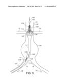 GATE WIRE FOR CONTRALATERAL LEG ACCESS diagram and image