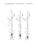 CATHETER diagram and image