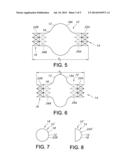 SAC LINER FOR ANEURYSM REPAIR diagram and image