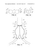 SAC LINER FOR ANEURYSM REPAIR diagram and image