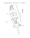 METHODS AND APPARATUSES FOR DEPLOYING MINIMALLY-INVASIVE HEART VALVES diagram and image