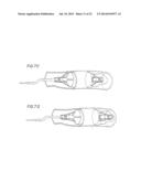 METHODS AND APPARATUSES FOR DEPLOYING MINIMALLY-INVASIVE HEART VALVES diagram and image