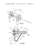 METHODS AND APPARATUSES FOR DEPLOYING MINIMALLY-INVASIVE HEART VALVES diagram and image