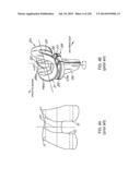 PATIENT-ADAPTED AND IMPROVED ARTICULAR IMPLANTS, DESIGNS AND RELATED GUIDE     TOOLS diagram and image