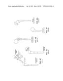 PATIENT-ADAPTED AND IMPROVED ARTICULAR IMPLANTS, DESIGNS AND RELATED GUIDE     TOOLS diagram and image