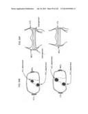 PATIENT-ADAPTED AND IMPROVED ARTICULAR IMPLANTS, DESIGNS AND RELATED GUIDE     TOOLS diagram and image