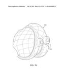 PATIENT-ADAPTED AND IMPROVED ARTICULAR IMPLANTS, DESIGNS AND RELATED GUIDE     TOOLS diagram and image