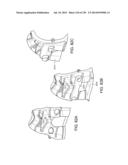 PATIENT-ADAPTED AND IMPROVED ARTICULAR IMPLANTS, DESIGNS AND RELATED GUIDE     TOOLS diagram and image